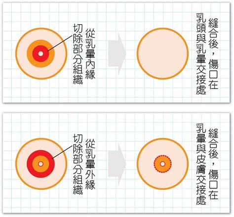 乳暈黑點|乳暈上有「小顆粒」正常嗎？乳暈顏色和別人不一樣？女孩到女人。